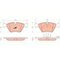 KLOCKI HAM. BMW P. E39 10/96-